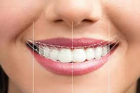 Smile Makeovers 101 What To Expect From Cosmetic Dentistry