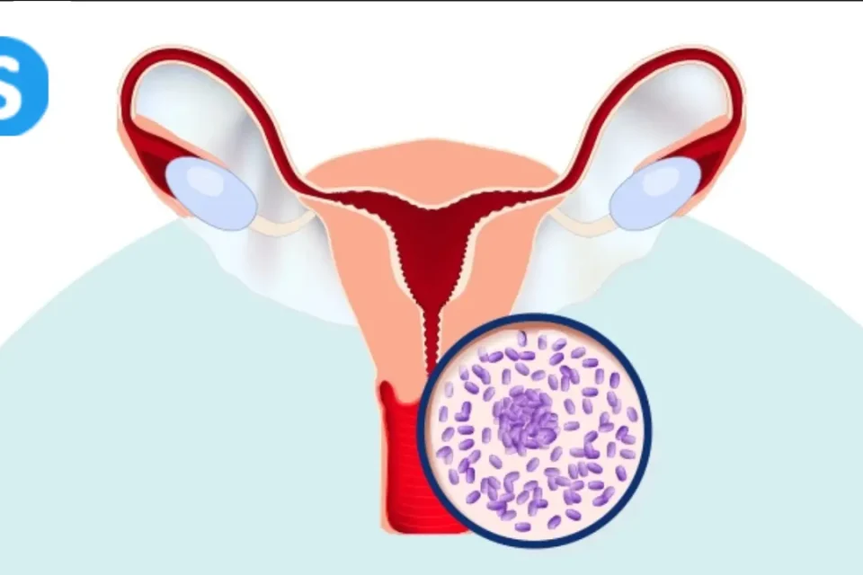 Mixed Urogenital Flora Meaning